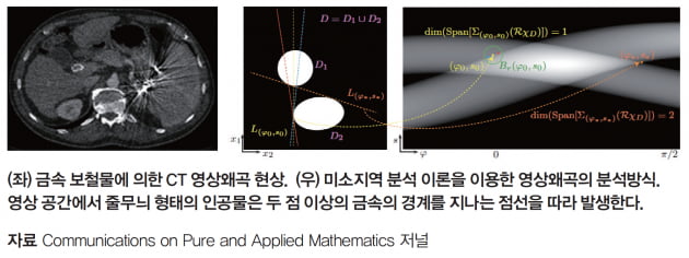 [수학과 만난 바이오×수리연] 의료 영상과 수학, 복원부터 화질 개선까지