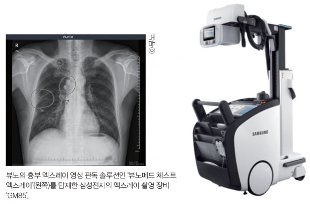 [이주현의 바이오 탐구영역] 국내 의료기기 업계에 AI 바람 몰고 온 뷰노