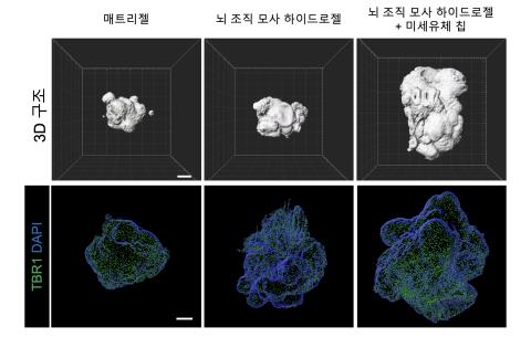 신생아 뇌 수준 '미니 뇌' 제작…치매 연구 등에 활용