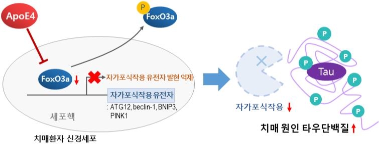 보건연구원 "환자뇌조직 분석해 알츠하이머 치매 악화기전 규명"