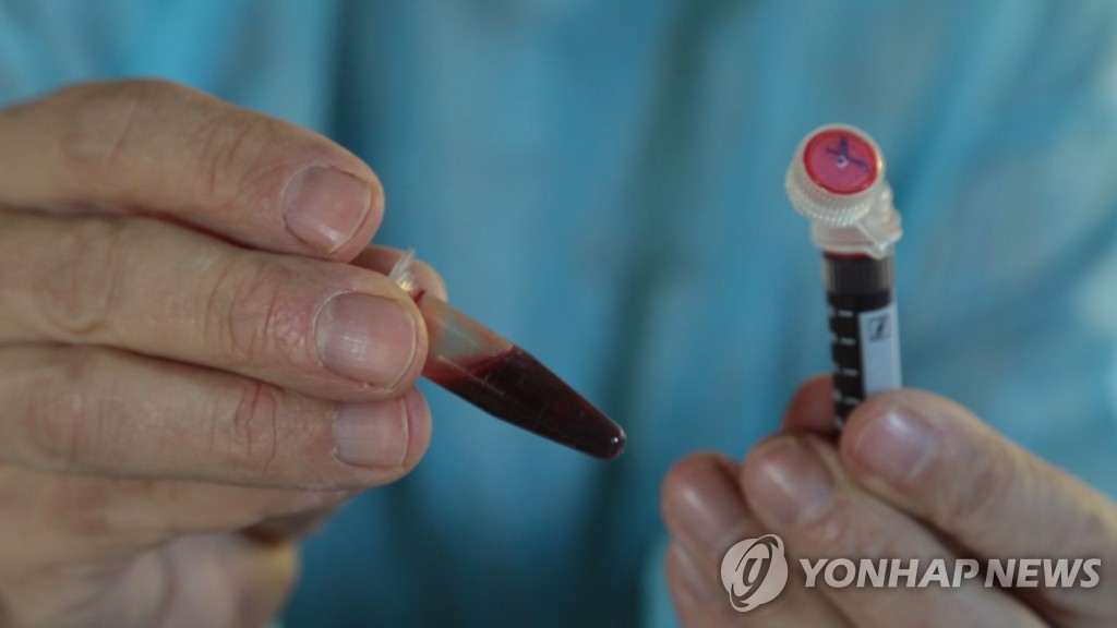 부산 영유아 파라인플루엔자 유행에 부모들 '발동동'