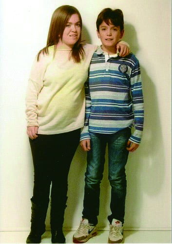 5세에 치료를 시작한 14세의 뮤코다당증 Ⅰ형 환자(왼쪽)와 생후 5개월부터 치료를 시작한 10세 뮤코다당증 Ⅰ형 환자(오른쪽)의 모습이다.
