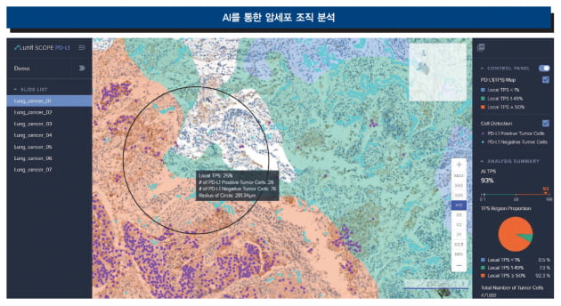 [Cover Story - INSIDE] 인공지능(AI)은 어떻게 진단의 영역을 바꾸는가