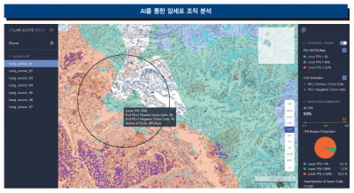  인공지능(AI)은 어떻게 진단의 영역을 바꾸는가