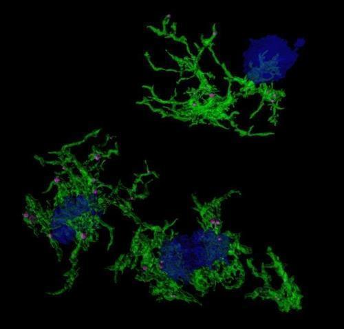 Processed Carbohydrate Foods Linked to Memory Impairment