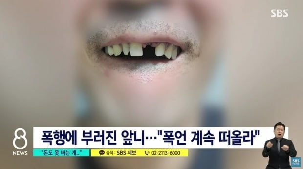 "엄마 욕해봐 빨리"…아빠뻘 택시기사 조롱하고 폭행한 20대