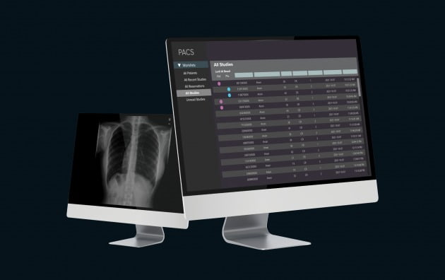 의료 AI 스타트업 루닛의 '루닛 인사이트 CXR 트리아지'. 루닛 제공 