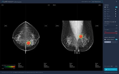 루닛, 국내 최초 AI 유방암 검출 솔루션 美 FDA 허가