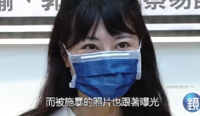 대만 女 국회의원 "남친이 호텔 감금해 목 조르고 폭행" 폭로 
