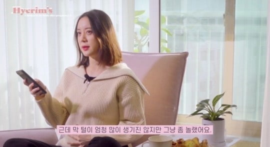 혜림 "배에 털 생겨 놀라"…임신부 당혹게 하는 '이것' 변화 [건강!톡]