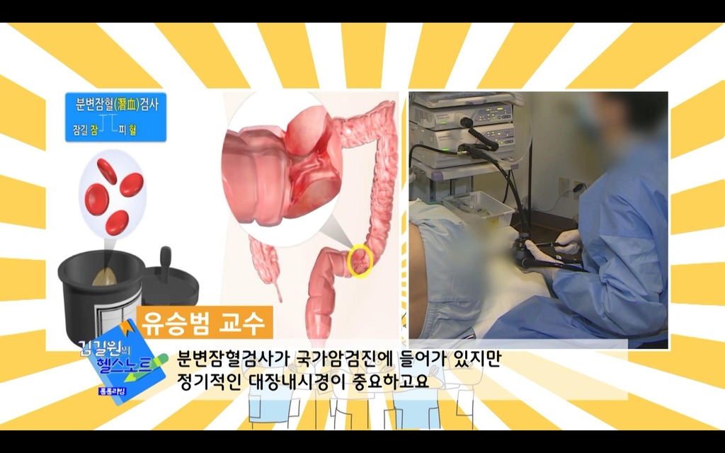 [김길원의 헬스노트] 대장내시경 하셨나요?…"안했다면 대장암 고위험군"