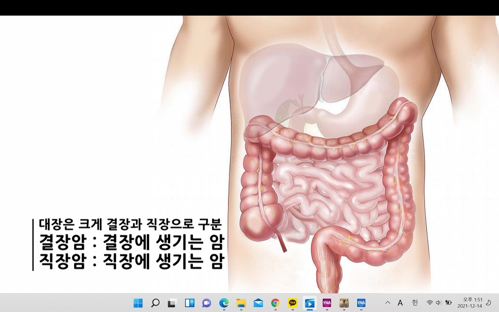 [김길원의 헬스노트] 대장내시경 하셨나요?…"안했다면 대장암 고위험군"