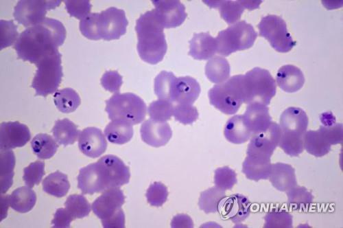 면역력 오래가는 백신, B세포에 이 효소 없으면 못 만든다