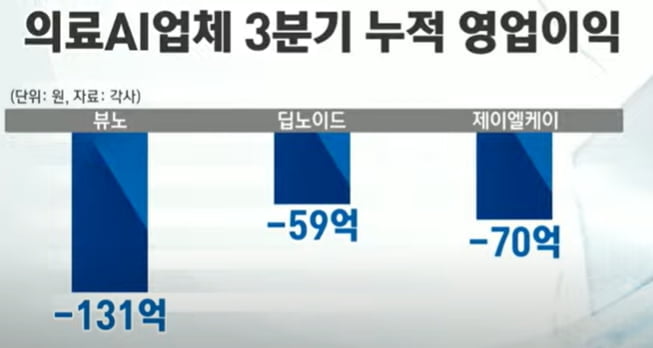 뷰노는 삼성, 루닛은 GE…의료AI, 대기업과 '맞손'