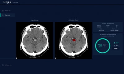 제이엘케이 "AI 뇌출혈 분석 솔루션, 사우디 진출 기대"