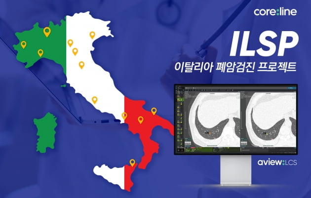 코어라인, 이탈리아 국립암센터에 폐암 검진 AI 솔루션 공급