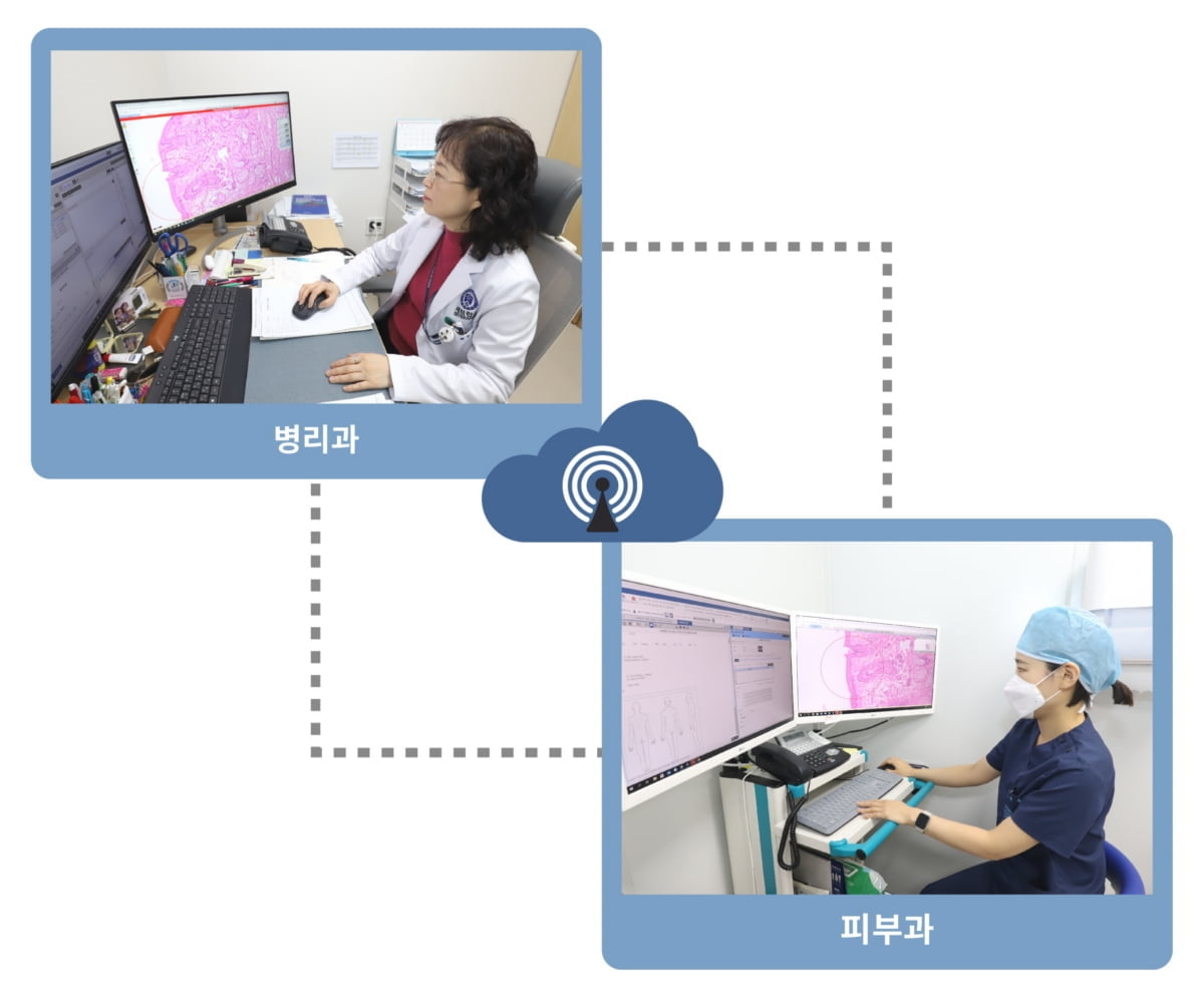 용인세브란스, 피부암 수술에 '디지털 병리' 활성화