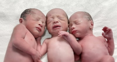 임인년 새해 첫날 고대 안암병원서 세쌍둥이 탄생