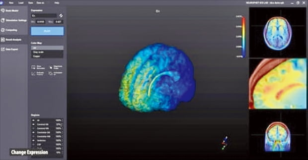 뉴로핏 뇌영상 분석 솔루션 구동 장면 일부 