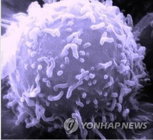 미 의료진 "CAR-T 세포, 백혈병 치료효과 10년 이상 지속"