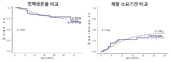 "방사선 색전술, 종양 큰 간암서 수술만큼 효과적"