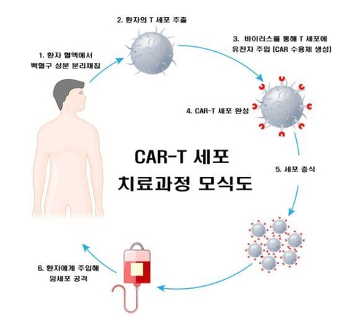 서울대병원, 카티치료제 자체 생산 개시…월말 환자 투약