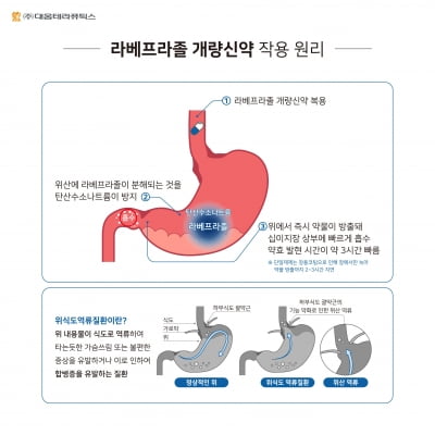 대웅테라퓨틱스, 제산제 더한 라베프라졸 개량신약 발매