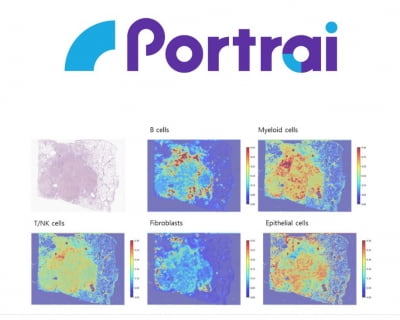 포트래이, 미국암학회에 핵심 서비스 2종의 개발 결과 발표