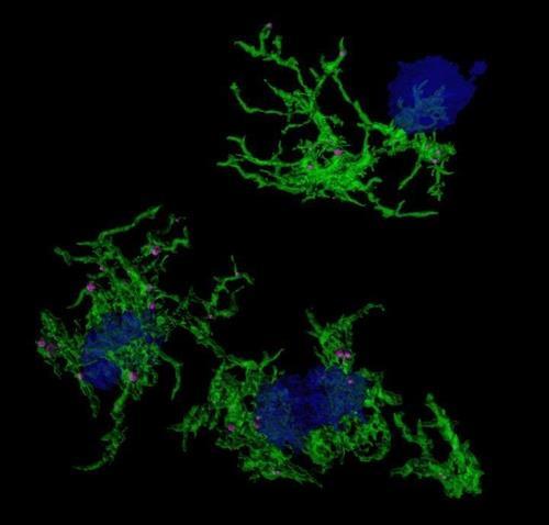 알츠하이머병 일으키는 타우 단백질의 '양성 피드백' 발견