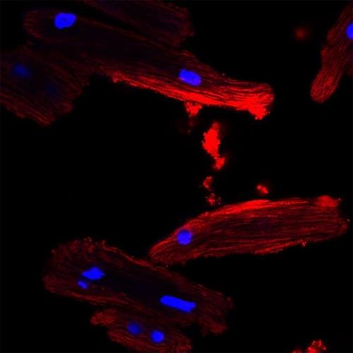 코로나19 RNA 백신을 지질 나노입자로 싸야 하는 이유