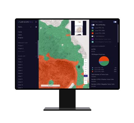 루닛, AI 병리분석 솔루션 '루닛 스코프 PD-L1' 유럽 인증 획득