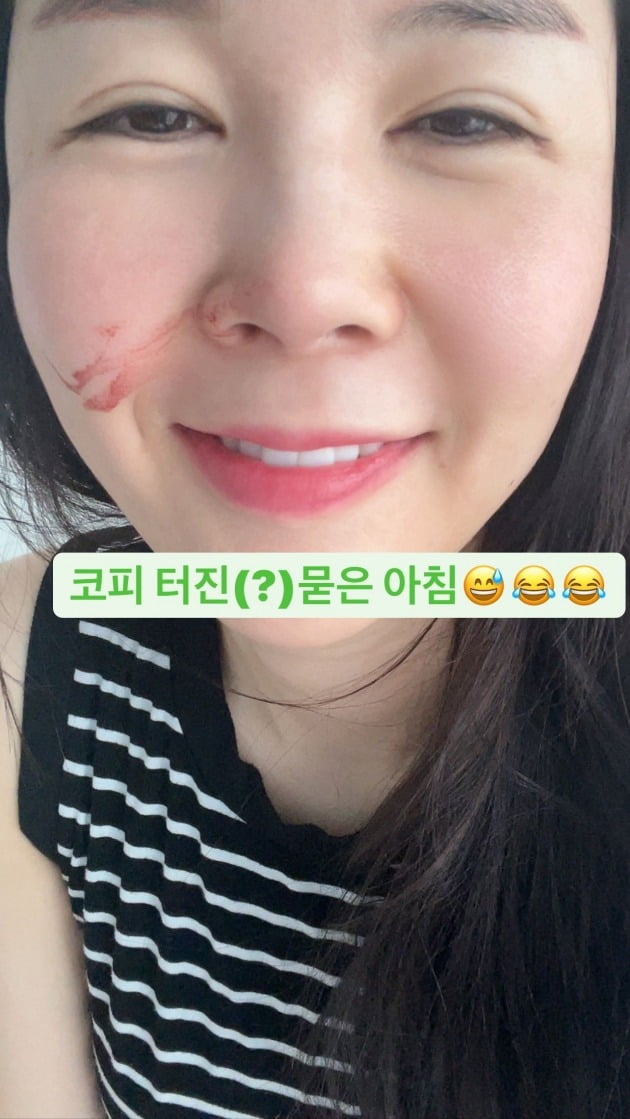 사진=장영란 인스타그램