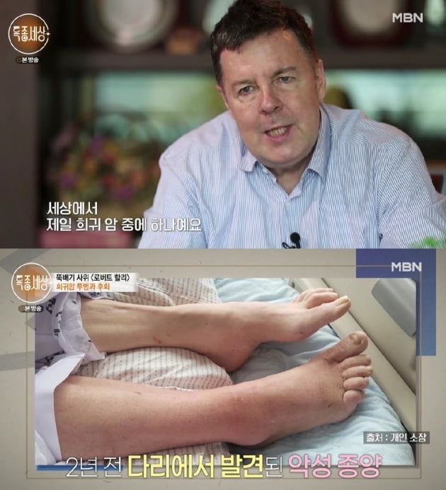 로버트 할리 /사진=MBN '특종세상' 