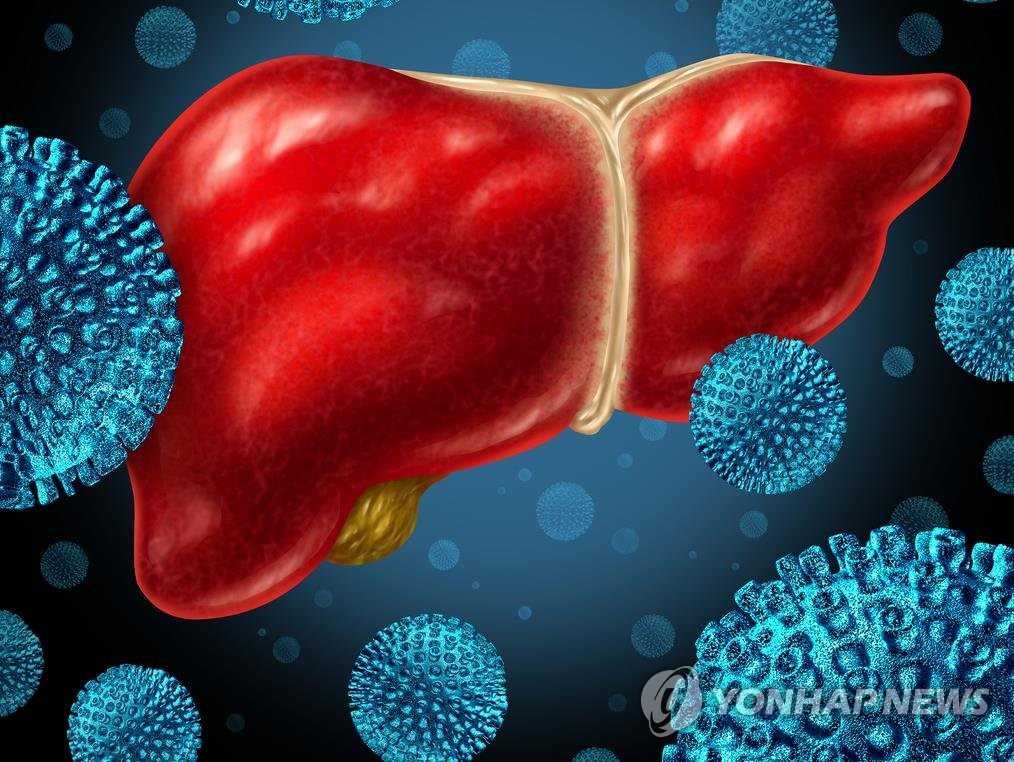 [고침] 사회(국내서 '원인불명 소아 급성 간염' 의심사례…)