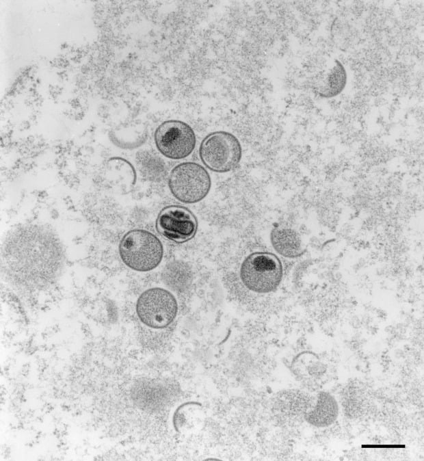 전자현미경에 포착된 원숭이두창 바이러스 /사진=AFP