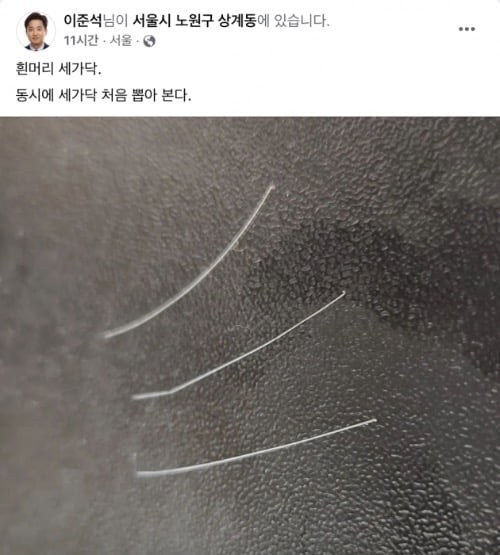 이준석 흰머리 3개 의미?…김근식 "안철수·윤핵관·배현진일수도"