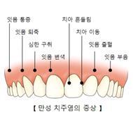 "임신 중 치주염, 조산 위험↑"