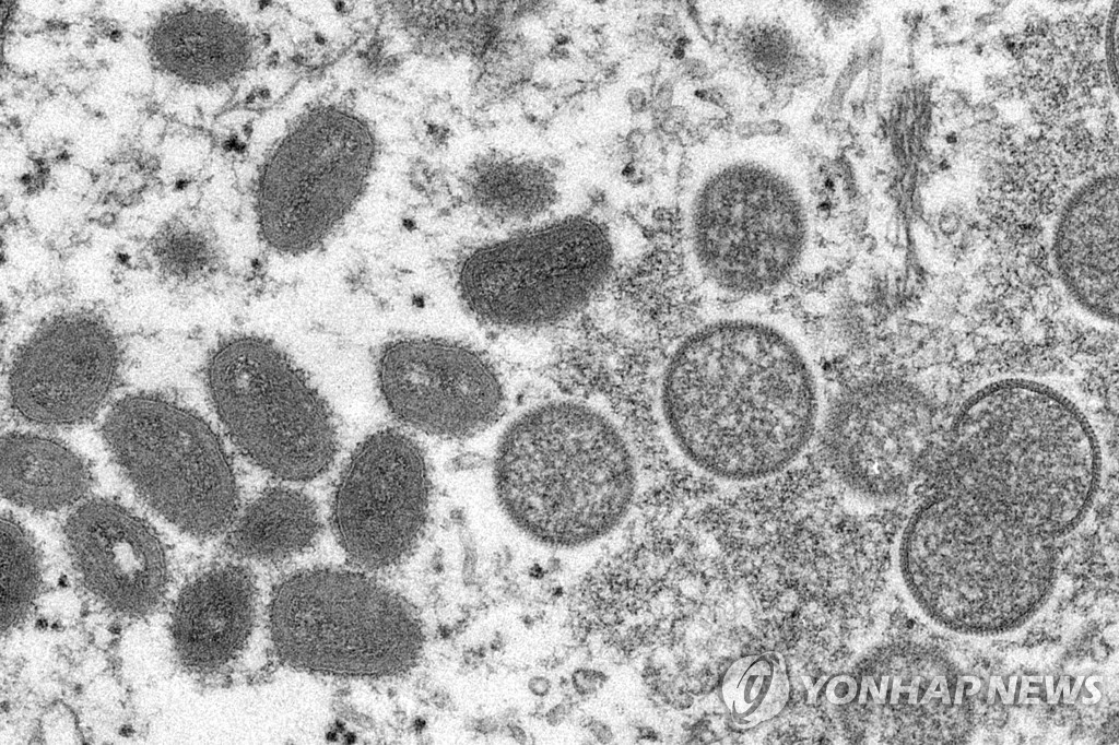 미 CDC, 원숭이두창 확산세에 긴급상황실 가동