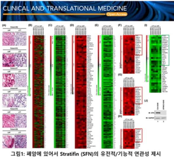 차백신연구소, 폐암세포 자가포식 조절 기전 제시