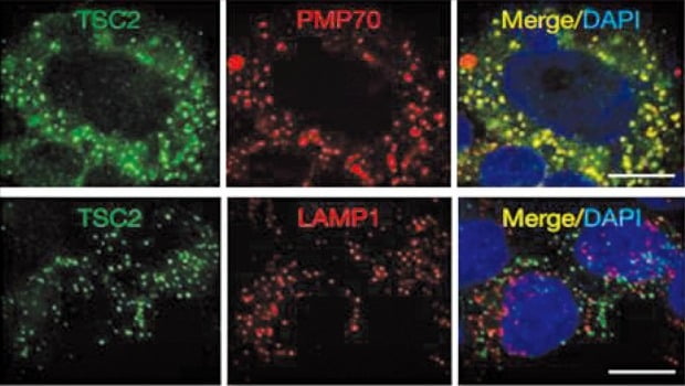 특정 단백질의 세포 내 위치 연구에 사용되는 형광물질. 초록과 빨강으로 표지된 두 단백질이 세포 내에서 같은 위치에 있을 경우에는 노란색으로 보인다. /출처 : (Nature Cell Biology, https://doi.org/10.1038/ncb2822) 