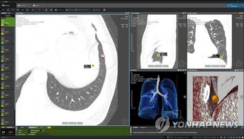 [스타트업 발언대] "これは、どのグローバル企業の製品よりも優れています。"