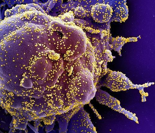 '감기 바이러스' 면역에 비춰본 '신종 코로나'의 미래