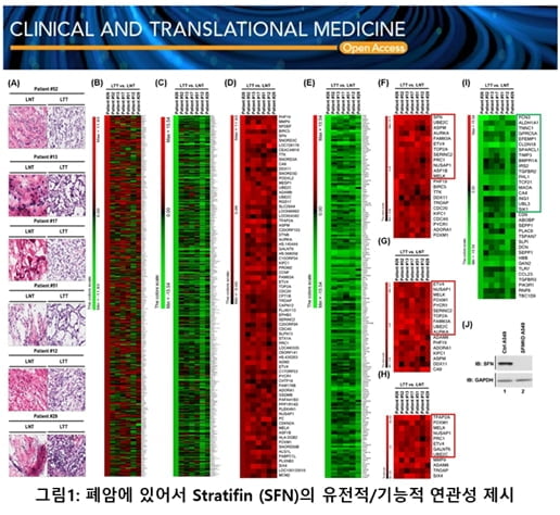 차백신연구소, 폐암환자 데이터 기반 폐암 진행 조절 메커니즘 제시