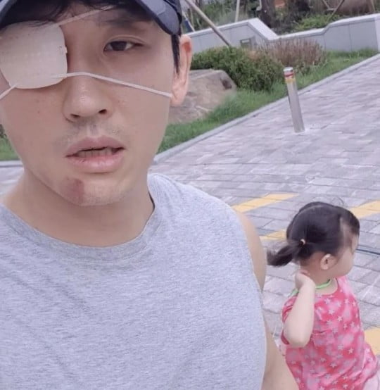 박지헌, 구안와사 투병 근황 "웃으면 입이 돌아가"