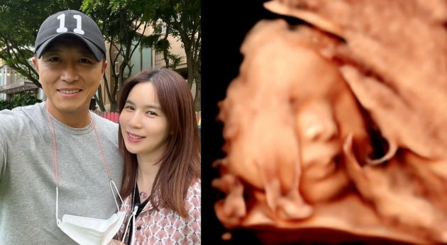 진태현, ♥박시은 임신 9개월차에 "1.8kg 베이비, 첫째도 감사해" 뭉클 [TEN★]