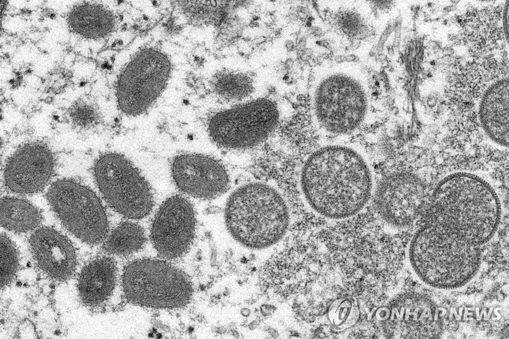 태국서 첫 원숭이두창 감염자 확인…나이지리아 남성