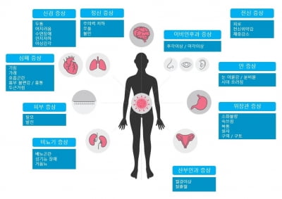 "코로나 후유증, 감염 4주 뒤에는 복합증상 치료 필요"