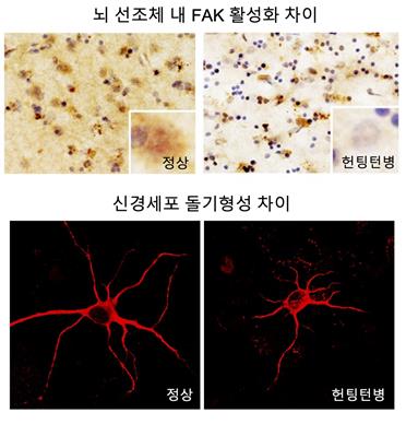 KIST "헌팅턴병 뇌기능장애 유발 'FAK 단백질' 규명"