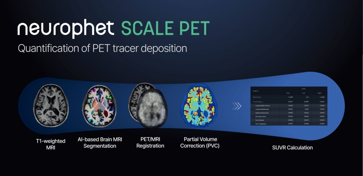 뉴로핏, PET 영상 분석 소프트웨어 '뉴로핏 스케일 펫' 美 FDA 허가 획득