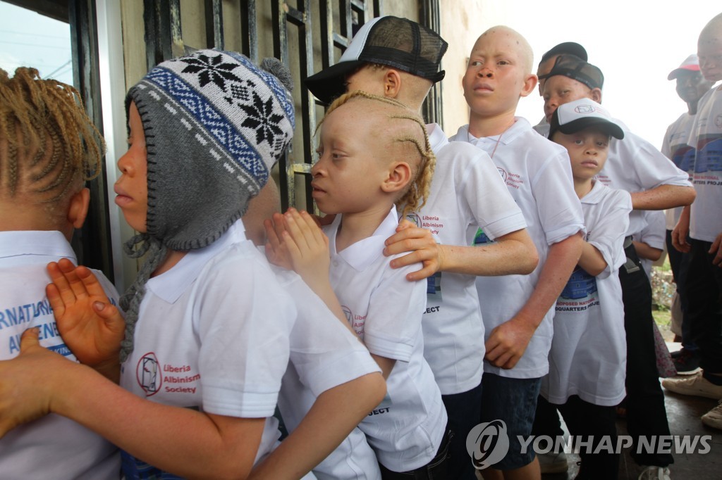 마다가스카르 경찰 '알비노 납치' 성난 군중에 발포…18명 사망